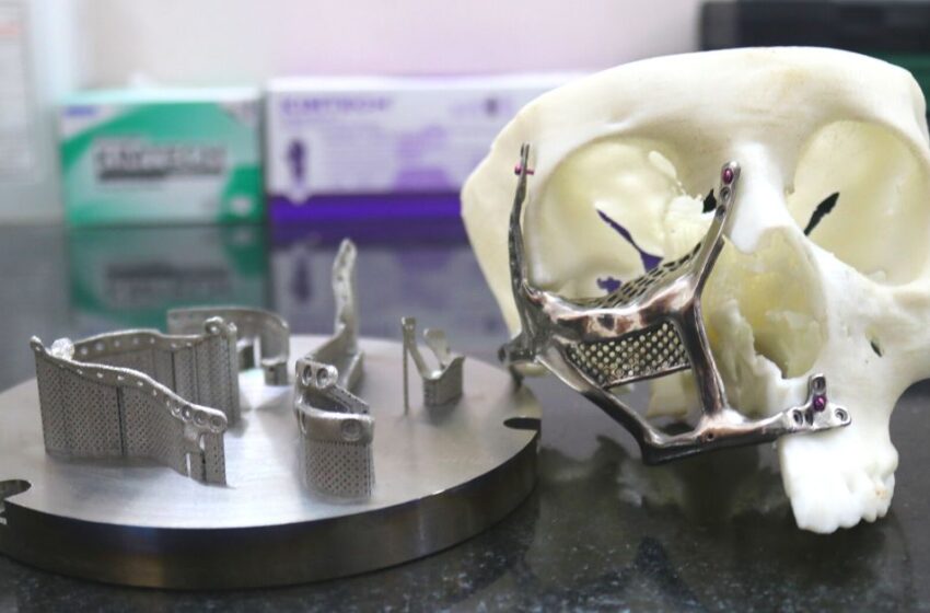  IIT Madras Innovates 3D-Printed Face Implants to Combat Deadly Mucormycosis