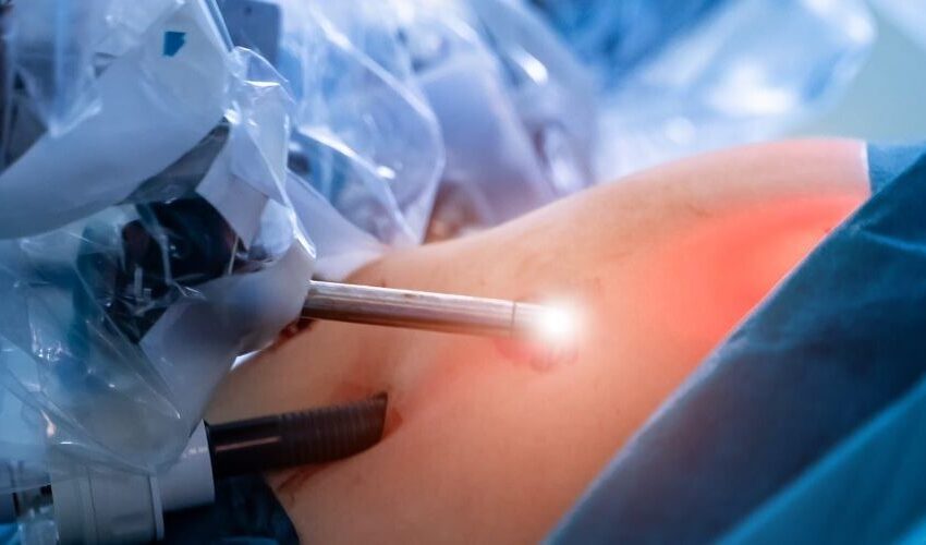  Pune Surgeons Remove India’s Largest Adrenal Cyst Using Minimally Invasive 3D Laparoscopy