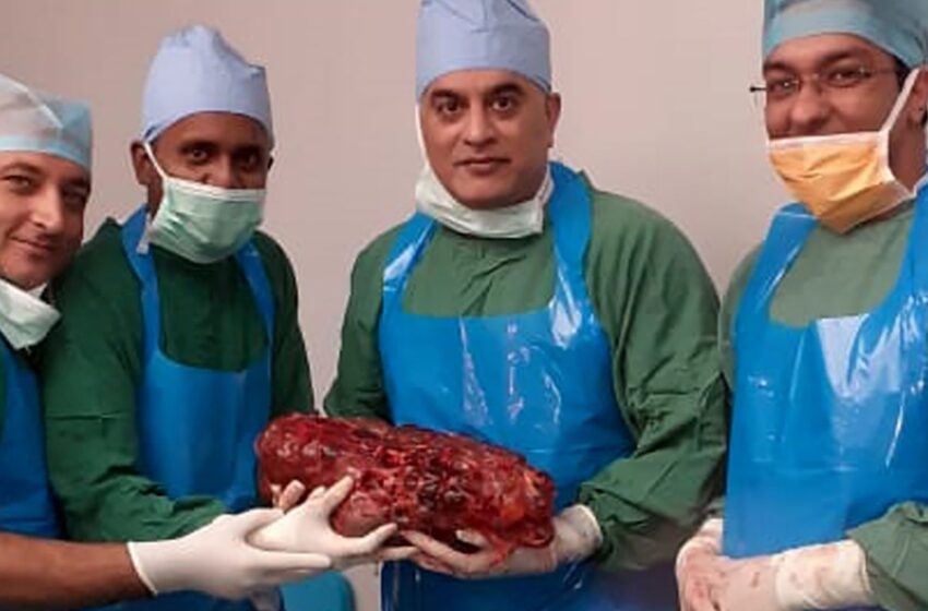  Bengaluru Doctors Remove One of the Heaviest Diseased Kidneys at Ramaiah Medical College