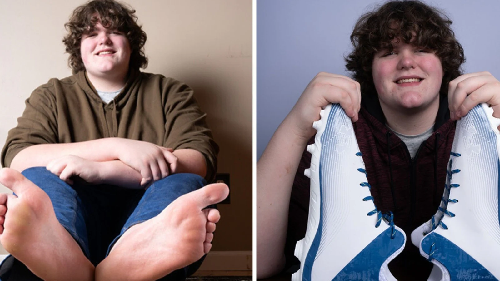  Teen Sets World Record for Largest Feet