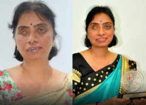 India’s First Blind Woman Chartered Accountant Breaks Barriers, Yet Remains Unsung