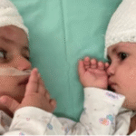 Brazilian Woman Gives Birth to Twins with Different Fathers in Rare Medical Case