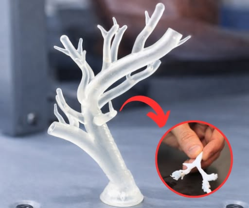  First Windpipe Grown From a Patient’s Own Cells Transforms Modern Medicine