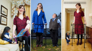 World’s Tallest Woman Rumeysa Gelgi Continues to Inspire Worldwide
